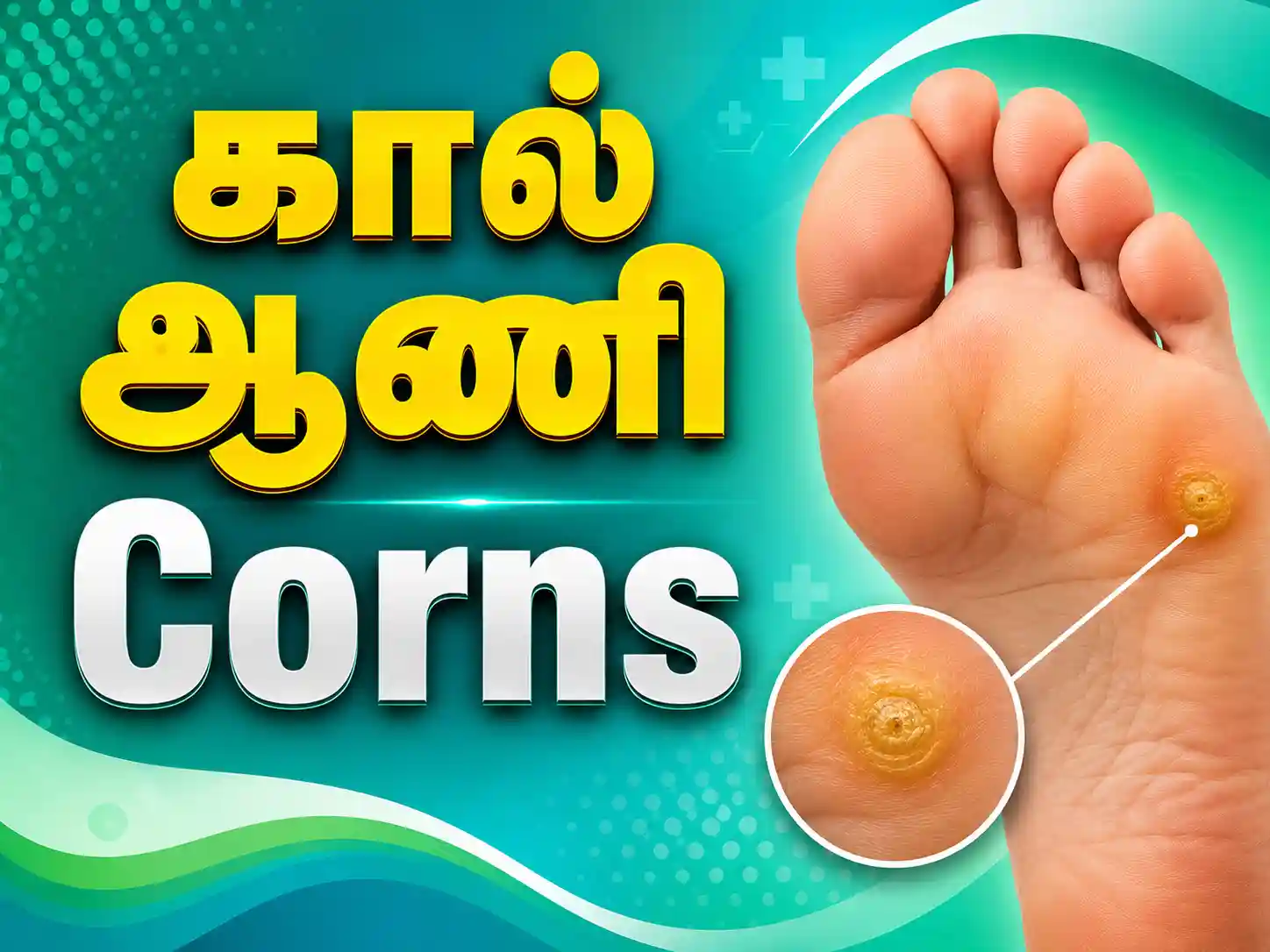 Corns treatment in Karur