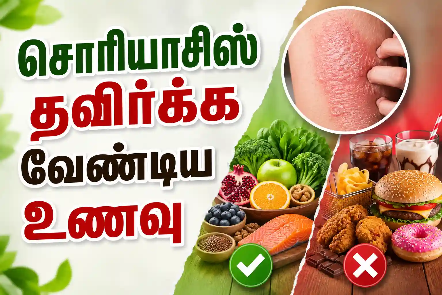 Psoriasis Food to avoid in tamil Psoriasis Diet in Tamil